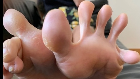 bunionprincess OnlyFans - Free Access to 32 Videos & 49 Photos Onlyfans Free Access