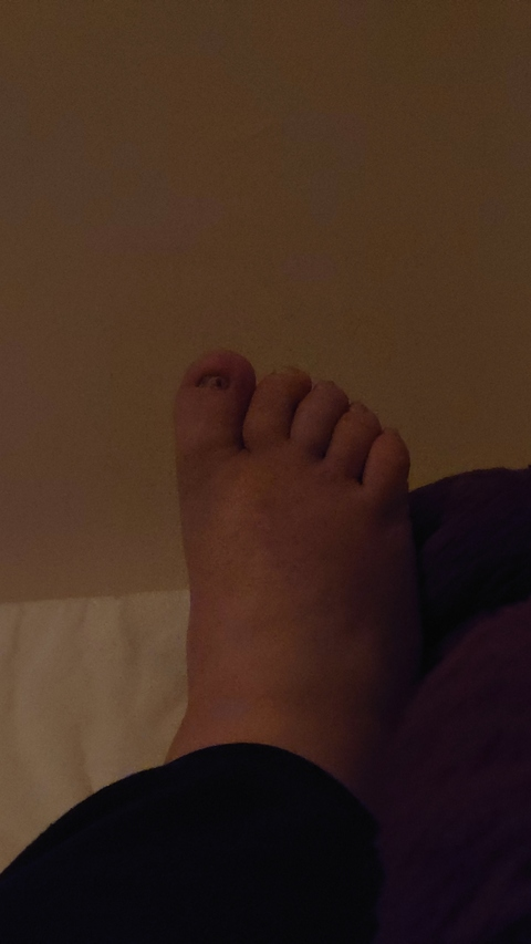 fatfeet.22 OnlyFans - Free Access to 32 Videos & 49 Photos Onlyfans Free Access