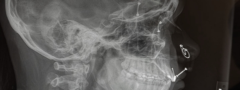 macadamiacookie OnlyFans - Free Access to 32 Videos & 49 Photos Onlyfans Free Access